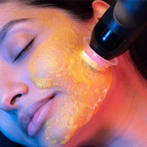 GENEO X - ROSTRO + CUELLO + ESCOTE