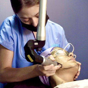 HOLLYWOOD PEEL LASER FACIAL