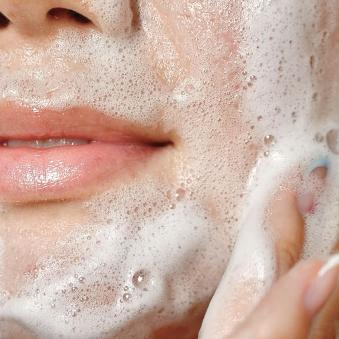 CLEAR SKIN FOTO FACIAL LIMPIEZA FACIAL PROFUNDA FOTO ACNÉ