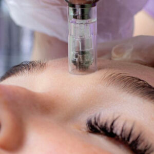 HYDRAFACIAL MD + GLASS SKIN PROTOCOL + PDRN de Salmon + Microneedling + Antiox Mask