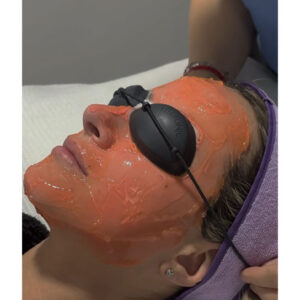 HYDRAFACIAL RADIANCE