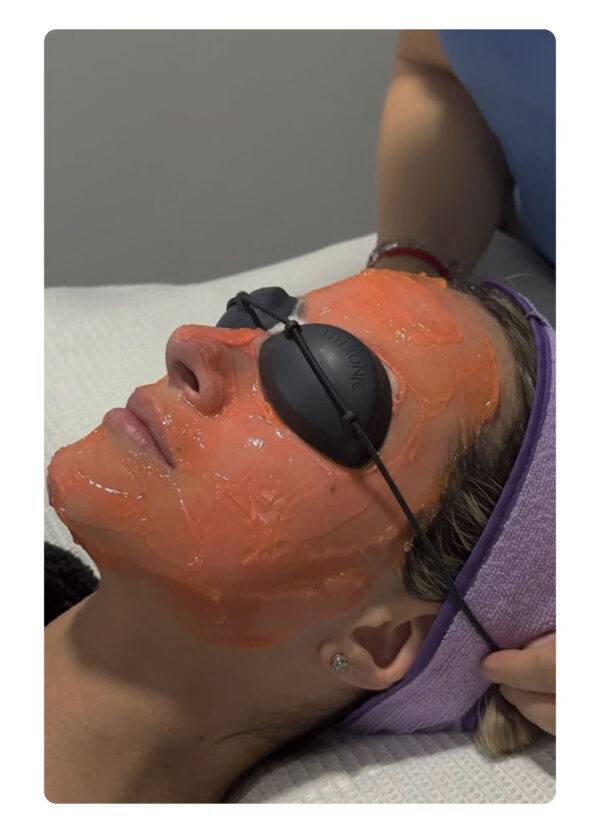 HYDRAFACIAL RADIANCE