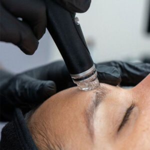 THE SKINCEUTICALS™ ANTIOX PROTOCOL X HYDRAFACIAL MD