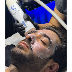 FIRE & FROST FACIAL ( GLACIAL FX + FIRE & ICE ISCLINICAL )