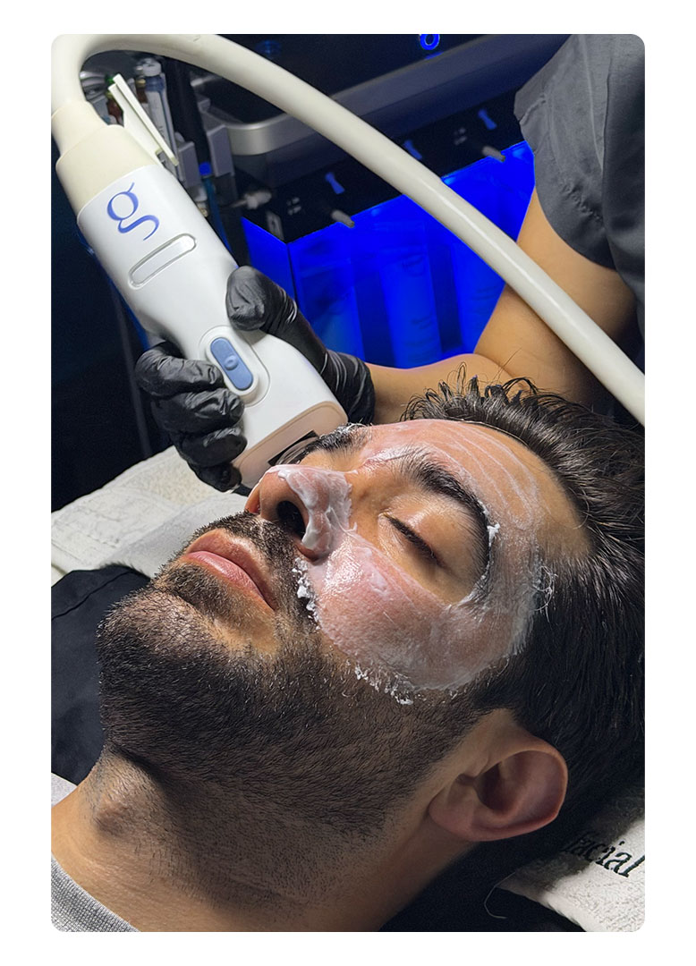FIRE & FROST FACIAL ( GLACIAL FX + FIRE & ICE ISCLINICAL )