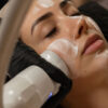 HYDRAFACIAL FROST