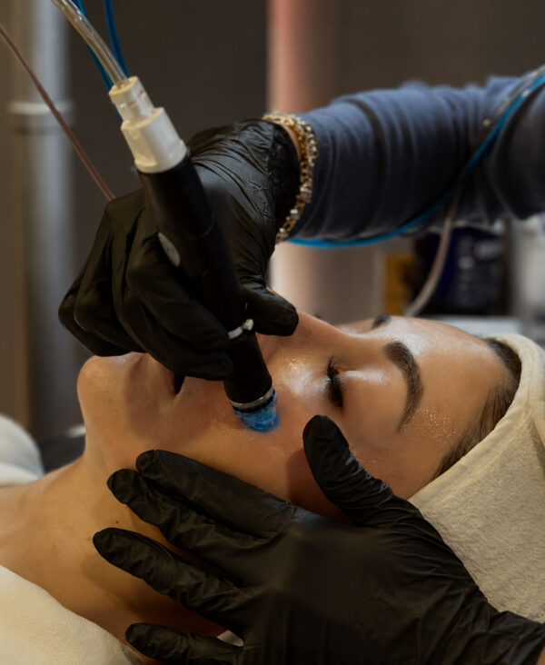 Alternative view of HYDRAFACIAL FROST