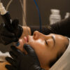 HYDRAFACIAL BOOSTED
