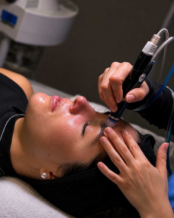 Alternative view of HYDRAFACIAL ESSENTIAL