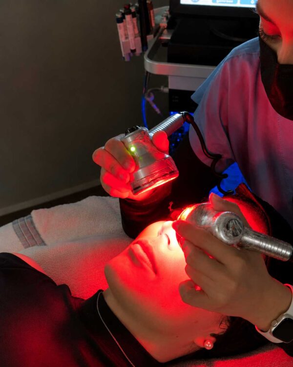 HYDRAFACIAL ESSENTIAL - Imagen 3