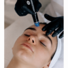 Hydrafacial Kids and teens