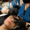 HYDRAFACIAL EXOSOME