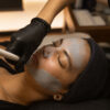 HYDRAFACIAL OIL CONTROL